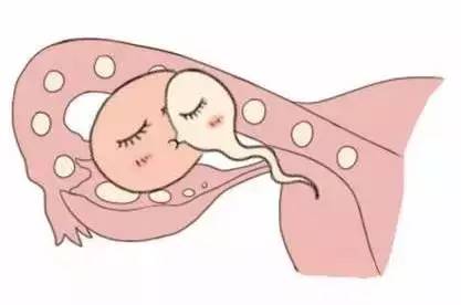 那里有正规供卵代孕
